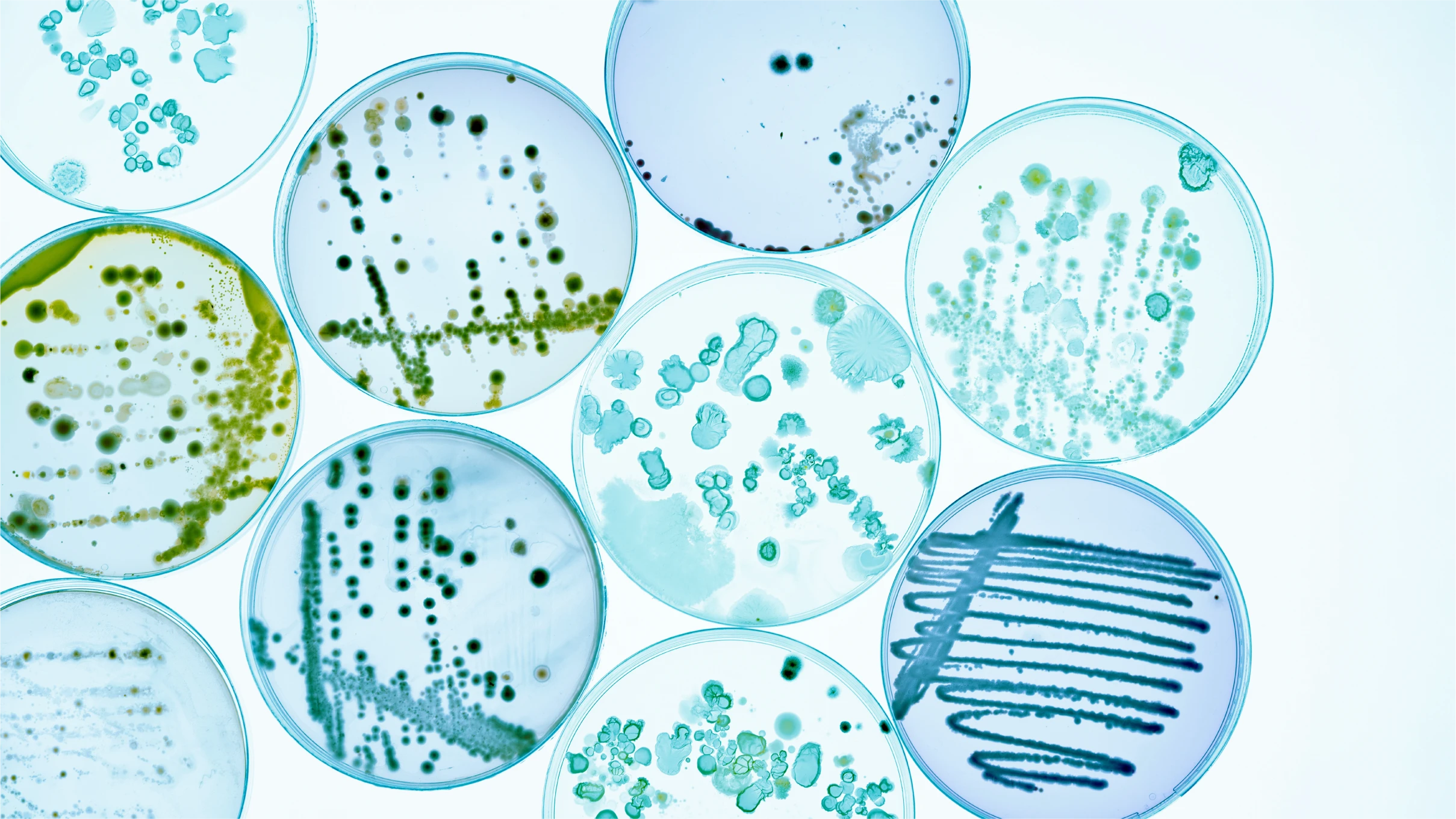 10 petri dishes with stained bacterial colonies
